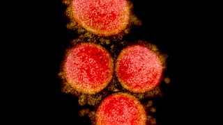 SARS-CoV-2 virus particles, isolated from a patient. 