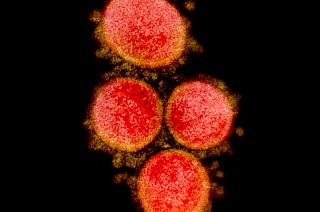SARS-CoV-2 virus particles, isolated from a patient.