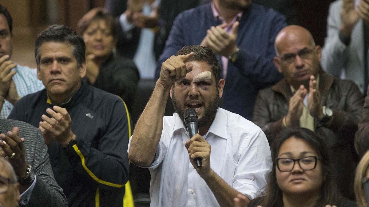 El diputado opositor Juan Requesens fue puesto en arresto domiciliario después de haber pasado más de dos años en la cárcel. La medida podría ser un gesto de Nicolás Maduro.