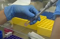 Koronavírus-teszt tesztelése a Palacky Egyetemen
