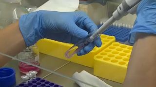 Koronavírus-teszt tesztelése a Palacky Egyetemen 