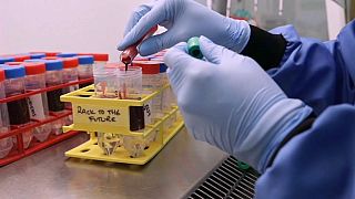 Covid-19: ripresi i test sul vaccino Oxford-AstraZeneca, in Francia più di 10mila nuovi casi