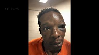 صورة لمواطن أمريكي أسود يدعى رودريك وولكر وهو في مركز الشرطة بعد أن أوسع ضربا على يد رجلي أمن  