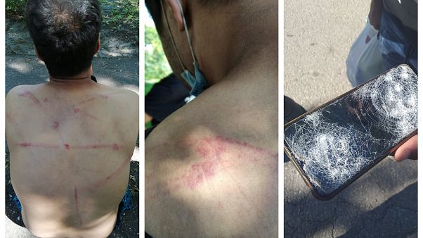 Migranti accusano la polizia rumena di violenze e respingimenti illegali nei pressi di Majdanpek, al confine con la Romania: foto dell'8 agosto 2020 Migranti accusano la polizia rumena di violenze e respingimenti illegali nei pressi di Majdanpek, al confine con la Romania: foto dell'8 agosto 2020