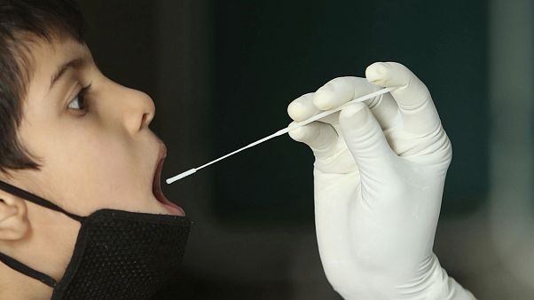 Koronavirüs'te son durum: Dünya genelinde vaka sayısı 30 milyonu aştı, can kaybı 1 milyon eşiğinde Koronavirüs'te son durum: Dünya genelinde vaka sayısı 30 milyonu aştı, can kaybı 1 milyon eşiğinde
