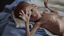 Selon l’ONU, 24 millions de Yéménites ont besoin d'aide humanitaire