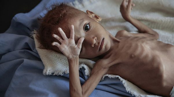 Selon l’ONU, 24 millions de Yéménites ont besoin d'aide humanitaire Selon l’ONU, 24 millions de Yéménites ont besoin d'aide humanitaire