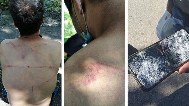 Migrants accuse the Romanian police of violence and illegal push-backs near Majdanpek, on the border with Romania. Photos taken on August 8, 2020 Migrants accuse the Romanian police of violence and illegal push-backs near Majdanpek, on the border with Romania. Photos taken on August 8, 2020
