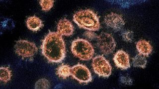 Rocky Mountain Laboratories shows SARS-CoV-2 virus particles which causes COVID-19, isolated from a patient in the U.S