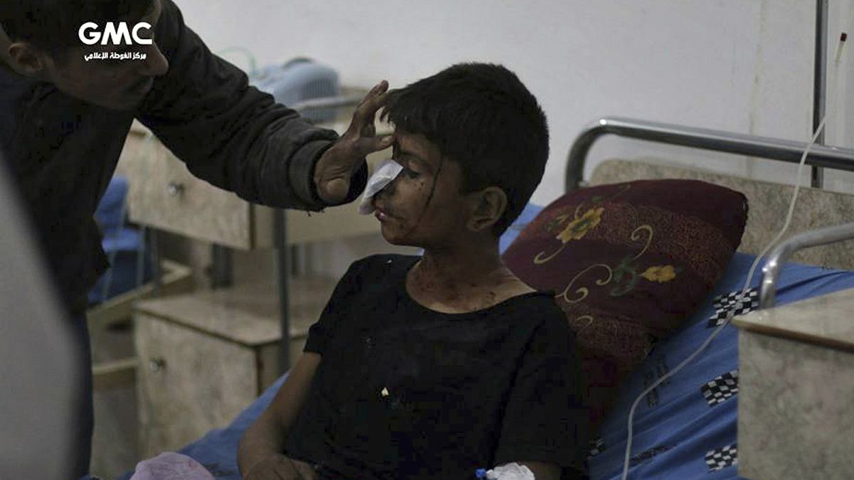 طفل من الغوطة الشرقية يتلقى العلاج بعد قصف طال البلدة