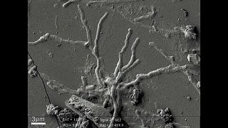 Neuronok egy 2000 éves agyból