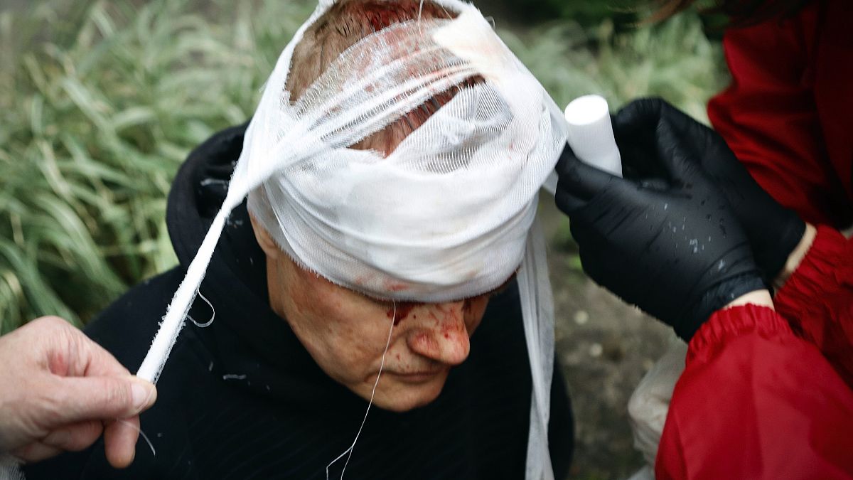متظاهر بيلاروسي أصيب في رأسه 