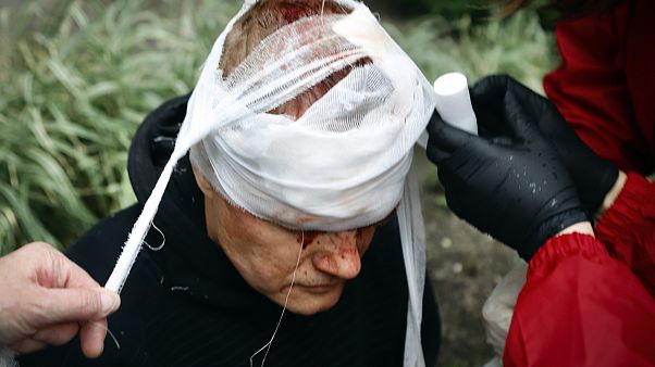 متظاهر بيلاروسي أصيب في رأسه متظاهر بيلاروسي أصيب في رأسه