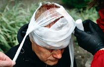 Sérült tüntetőt ápolnak Minszkben, október 11-én