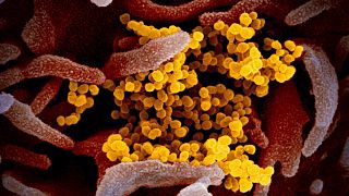 Koronavírus (sárga) elektronmikroszkóp alatt