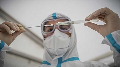 Personale sanitario inserisce un tampone di cotone in una provetta dopo aver effetturato il test PCR in un centro di Berlino, Germania, mercoledì 14 ottobre 2020