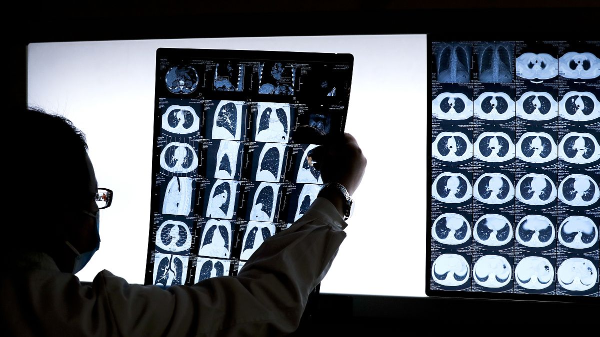 طبيب صيني ينظر في صورة ضوئية لمريض مصتب بسرطان الرئة في مستشفى جينغدونغ زونغمي في محافظة هوباي. 2016/12/08