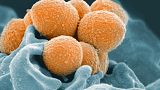 Esta imagen muestra una imagen de microscopio electrónico del estreptococo del grupo A (naranja) durante la interacción fagocítica con un neutrófilo humano (azul).