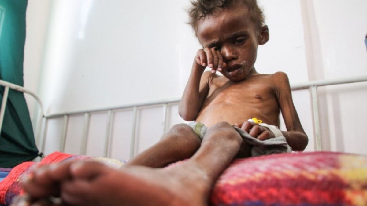 Yemenli bir çocuk