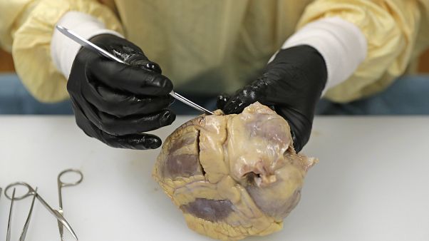 Covid-19'dan ölen bir hastanın kalbi Washington Tıp Fakültesi'nde incelenirken Covid-19'dan ölen bir hastanın kalbi Washington Tıp Fakültesi'nde incelenirken
