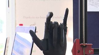 Tunisian Startup Develops a Customisable Bionic Hand Device