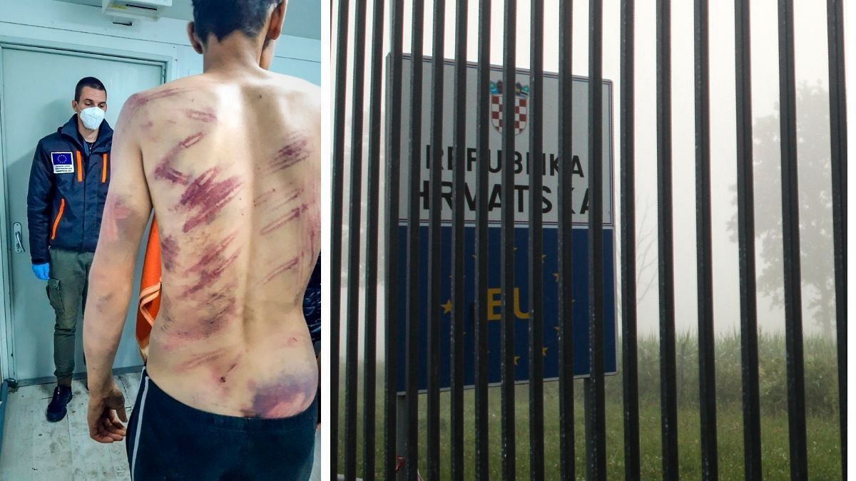 Imagen de la espalda de un migrante tras sufrir agresiones.
