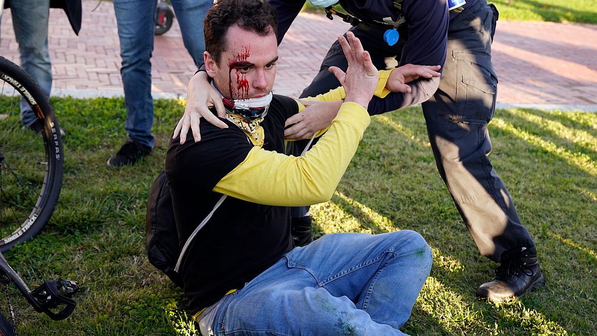 Un partidario del presidente Donald Trump herido después de ser atacado durante una manifestación pro-Trump, el 14 de noviembre de 2020, en Washington.