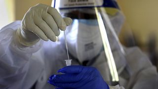 Amerika Birleşik Devletleri'nde tamamen evde yapılarak 30 dakika içinde sonuç veren bir hızlı koronavirüs testine ilk defa izin verildi