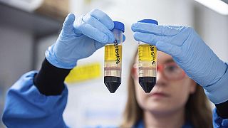 Forscherin arbeitet in einem Labor an einem Impfstoff gegen das Coronavirus, 23.11.2020
