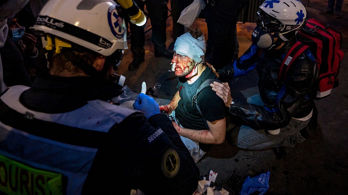 AFP ve Polka Magazine için çalışan serbest fotoğrafçı Ameeer Alhalbi, protesto sırasında yaralandı