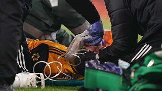 راوول خيمينيس يتلقى العلاج بعد اصطدامه بالرأس مع مدافع أرسنال ديفيد لويز خلال مباراة كرة القدم في الدوري الإنجليزي الممتاز بين أرسنال وولفرهامبتون ، لندن، 29 نوفمبر 2020