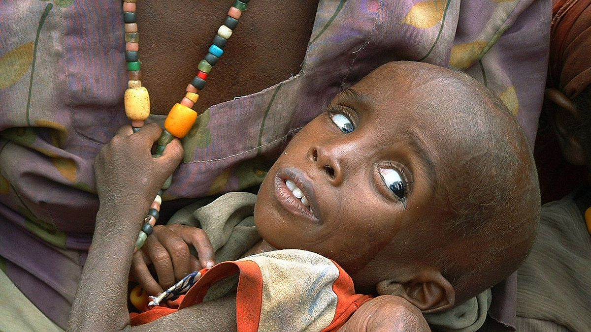 Etiyopya'da yardım bekleyen annesinin kucağında oturan bir çocuk (arşiv)