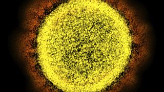 2020 electron microscope image made available by the National Institute of Allergy and Infectious Diseases shows a Novel Coronavirus SARS-CoV-2 particle isolated from a patien