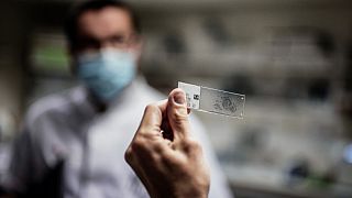 Пандемия отвлекает от диагностики и лечения рака