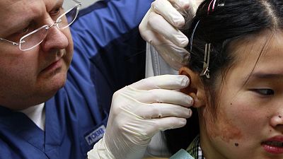 Protez kulak takılan bir hasta 