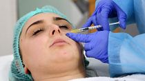 طبيبة امراض جلدية تجري علاجا تجميليا لامرأة في العاصمة الألبانية تيرانا. 2021/02/04