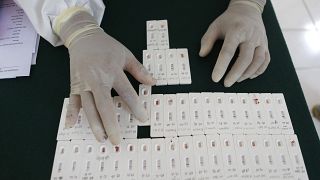 موظف صحي ينظم نتائج اختبار الأجسام المضادة لفيروس كورونا في مكتب في بالي، إندونيسيا،  أيلول / سبتمبر، 2020
