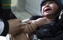 Afganistan'd aşı olan küçük bir çocuk.