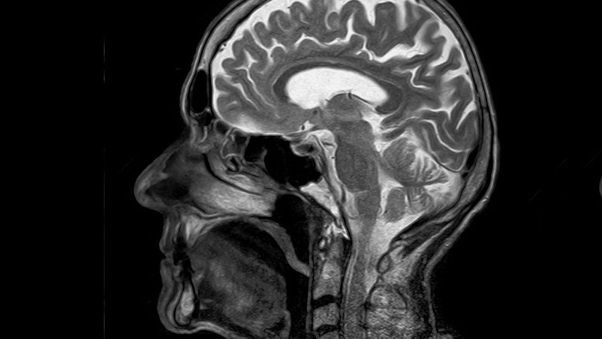 تصویر از مغز انسان