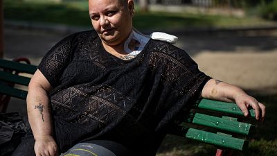 Cecilia Heyder, padece cáncer metastásico, lupus y un trastorno sanguíneo. Pide morir "con dignidad". Foto tomada en Santiago de Chile, el 15 de abril de 2021. 