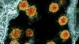 Archives :  molécules du Virus SARS-CoV-2, colorées pour être isolées et vues au microscope électronique