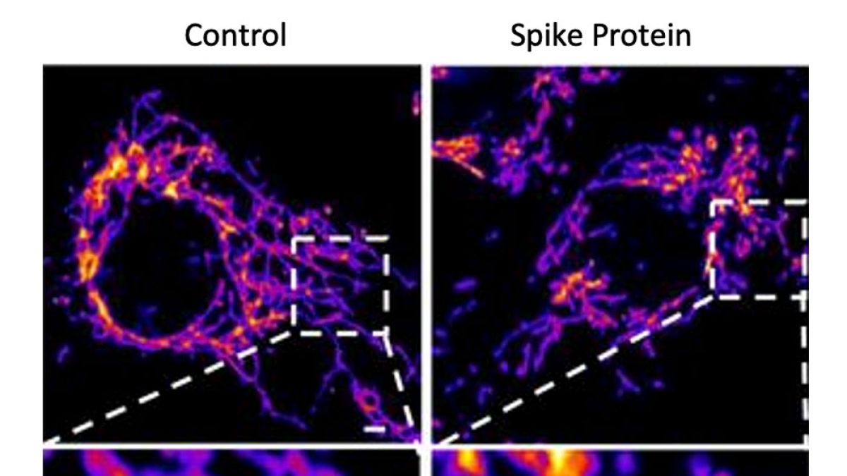 Células del endotelio sanas (izda.) y tratadas con la proteína S del coronavirus (dcha.) muestran fragmentación mitocondrial en el sistema vascular.