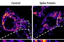 Healthy endothelial cells (left) and those treated with coronavirus protein S (right) show mitochondrial fragmentation in the vascular system.