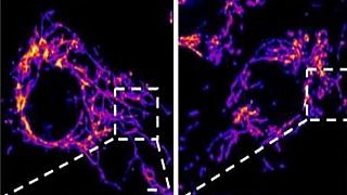 (على اليسار) الخلايا الغشائية السليمة، و(على اليمين) الخلايا التي تعرضت لبروتين فيروس كورونا "سبايك" الذي عمل على إتلاف الميتوكوندريا في خلايا غشاء الأوعية الدموية