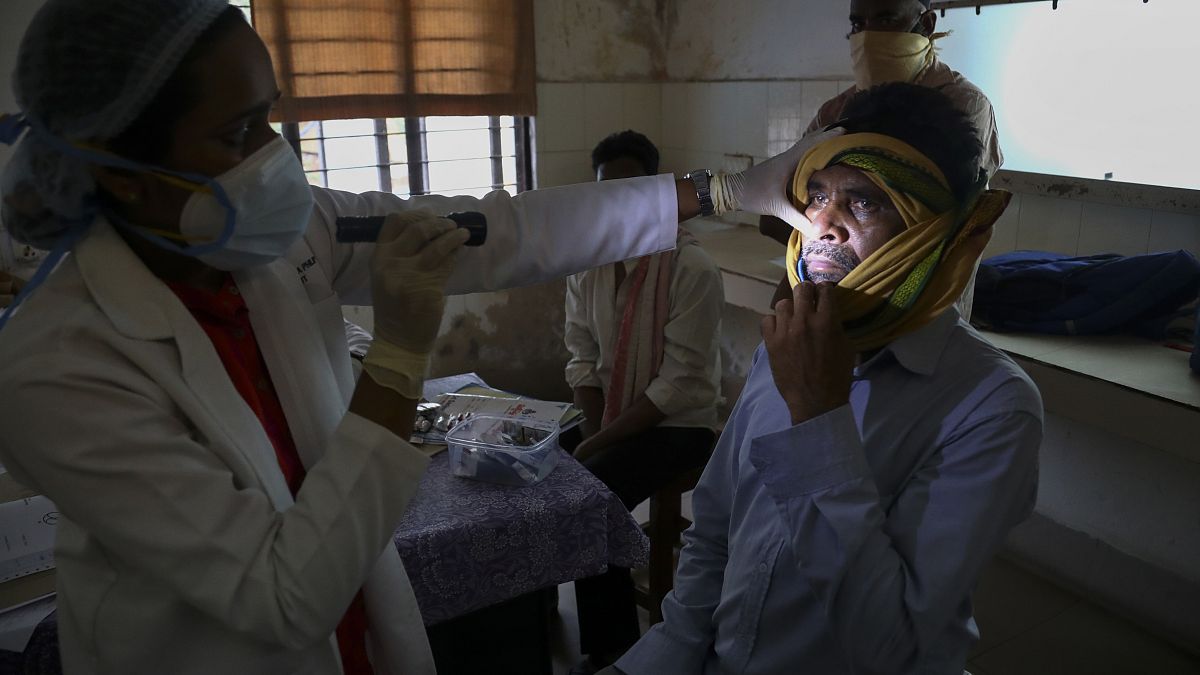 21 maggio 2021: un medico controlla un uomo guarito dal COVID-19 e ora  infettato dal fungo nero in un ospedale governativo a Hyderabad, India,