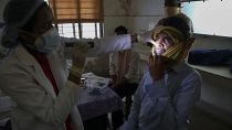 21 maggio 2021: un medico controlla un uomo guarito dal COVID-19 e ora  infettato dal fungo nero in un ospedale governativo a Hyderabad, India,
