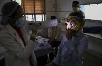 21 maggio 2021: un medico controlla un uomo guarito dal COVID-19 e ora  infettato dal fungo nero in un ospedale governativo a Hyderabad, India,