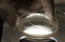 باحث متخصص يفحص الخلايا الجذعية الجنينية البشرية تحت المجهر