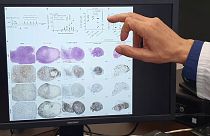 Diferencias ante el mismo tumor en ratones con y siin trimerbodies