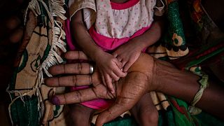 الأمم المتحدة تحذّر من خطر وفاة أكثر من 30 ألف طفل في ظل المجاعة في تيغراي